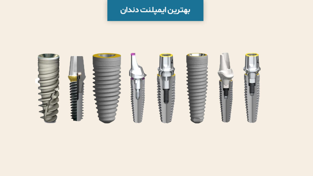 بهترین ایمپلنت دندان