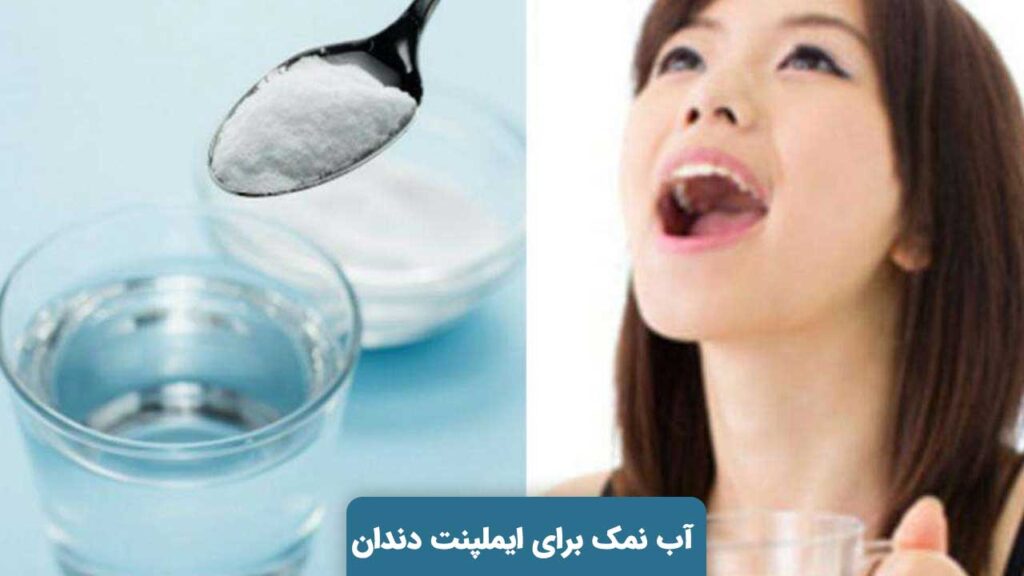 آب نمک برای ایملپنت دندان