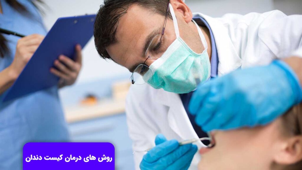 روش های درمان کیست دندان