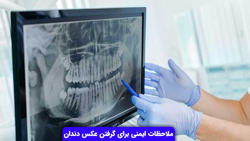 ملاحظات ایمنی برای گرفتن عکس دندان