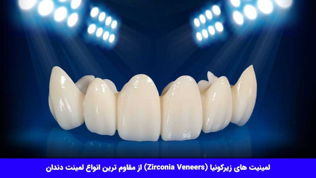 لمینیت دندان زیرکونیا (Zirconia Veneers)