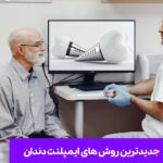 جدیدترین روش های ایمپلنت دندان