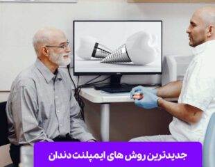 جدیدترین روش های ایمپلنت دندان