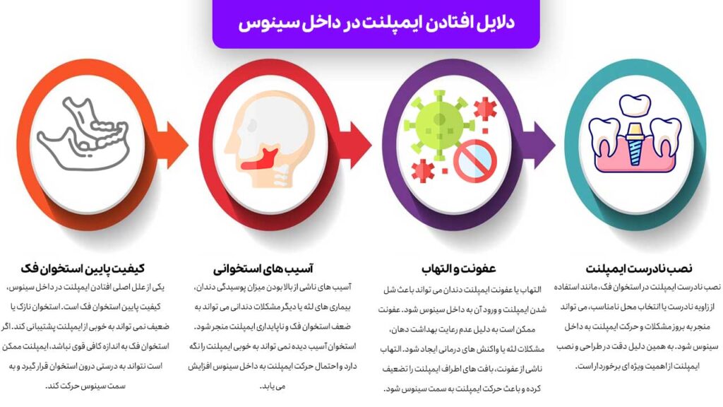 دلایل افتادن ایمپلنت در داخل سینوس