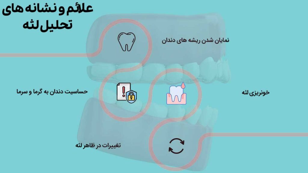 علائم و نشانه های
تحلیل لثه