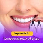 برای هر فک چند ایمپلنت لازم است؟