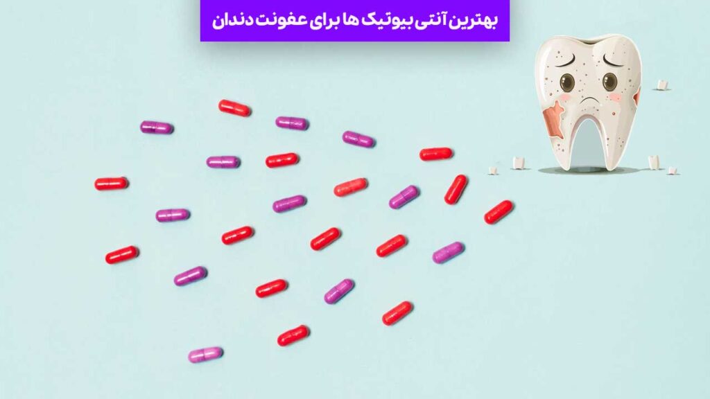 بهترین آنتی بیوتیک ها برای عفونت دندان