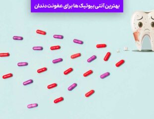 بهترین آنتی بیوتیک ها برای عفونت دندان