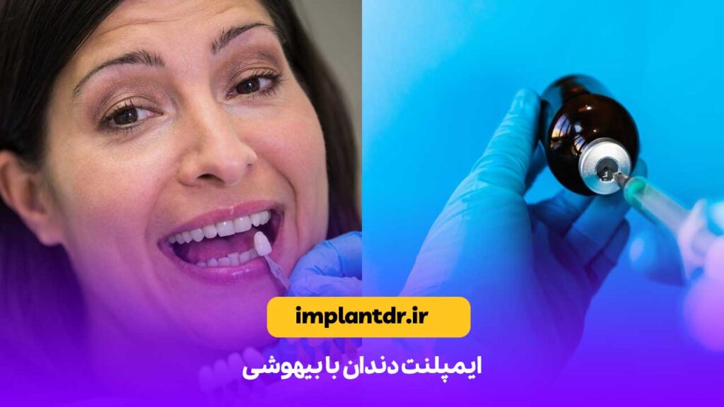 ایمپلنت دندان با بیهوشی