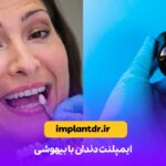 ایمپلنت دندان با بیهوشی