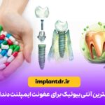 بهترین آنتی بیوتیک برای عفونت ایمپلنت دندان